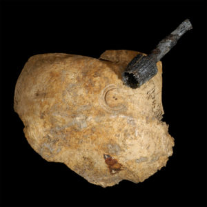 Surgically-Marked Skull Fragment
