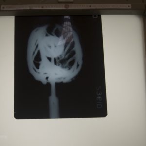 X-ray of a broadsword